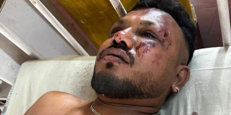 Vishwash Kumar Ramesh, reported by local media to be a survivor of the Air India flight 171 plane crash. From Hindustan Times