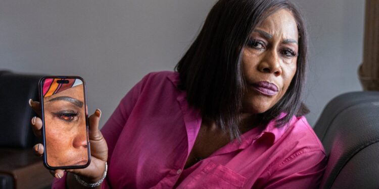 Rabbiatu Kuyateh shows a photograph of her bloodshot eye which she told Reuters was an injury sustained during deportation. REUTERS/Stringer