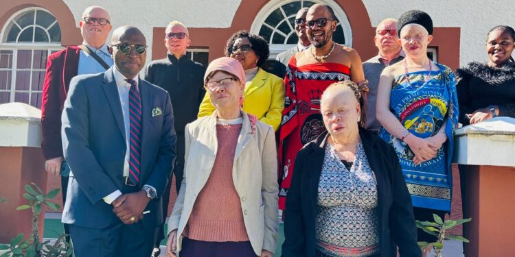 Government commits to inclusive society for persons with albinism